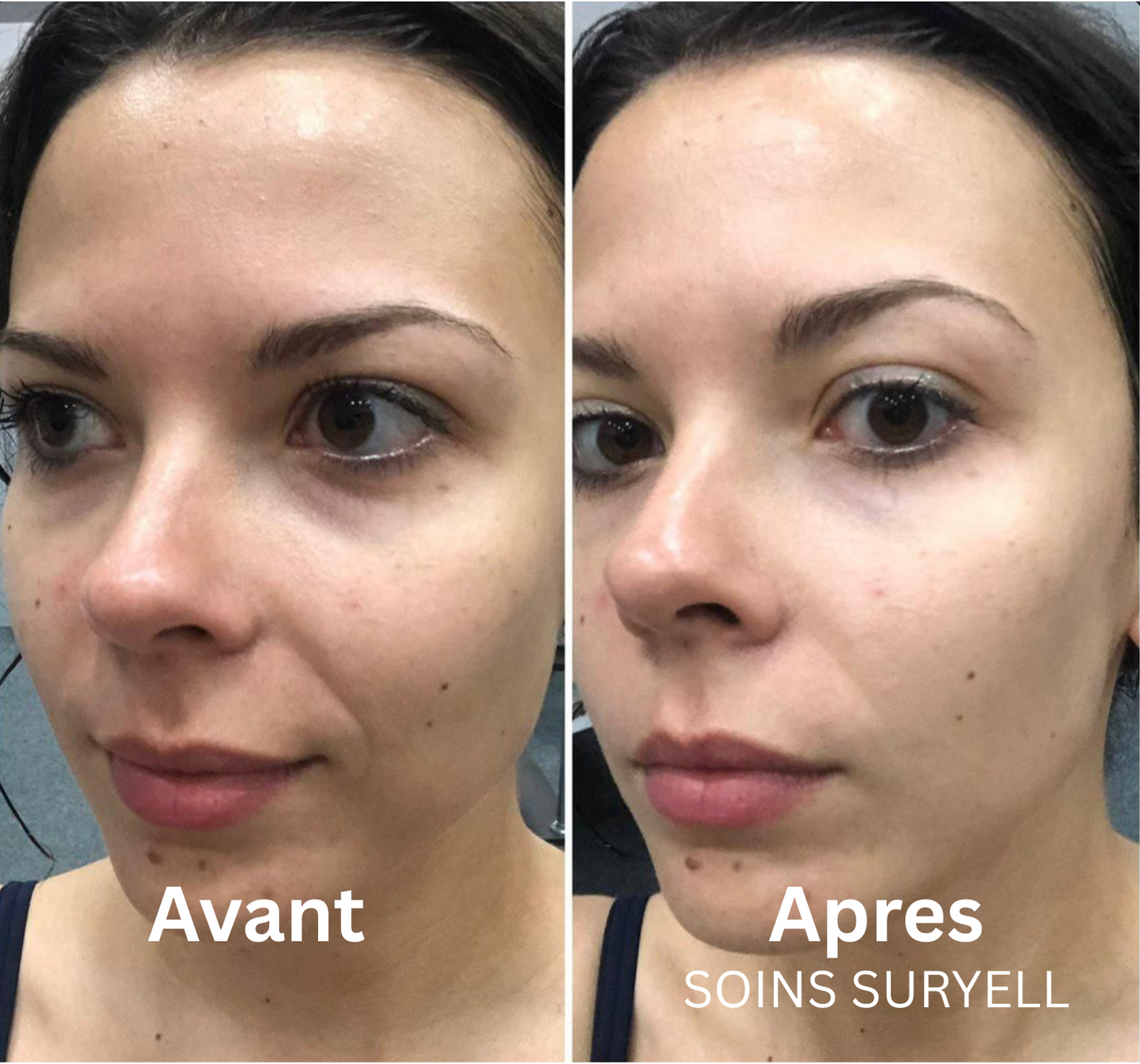 Soins Retinal Anti-Cernes instantané