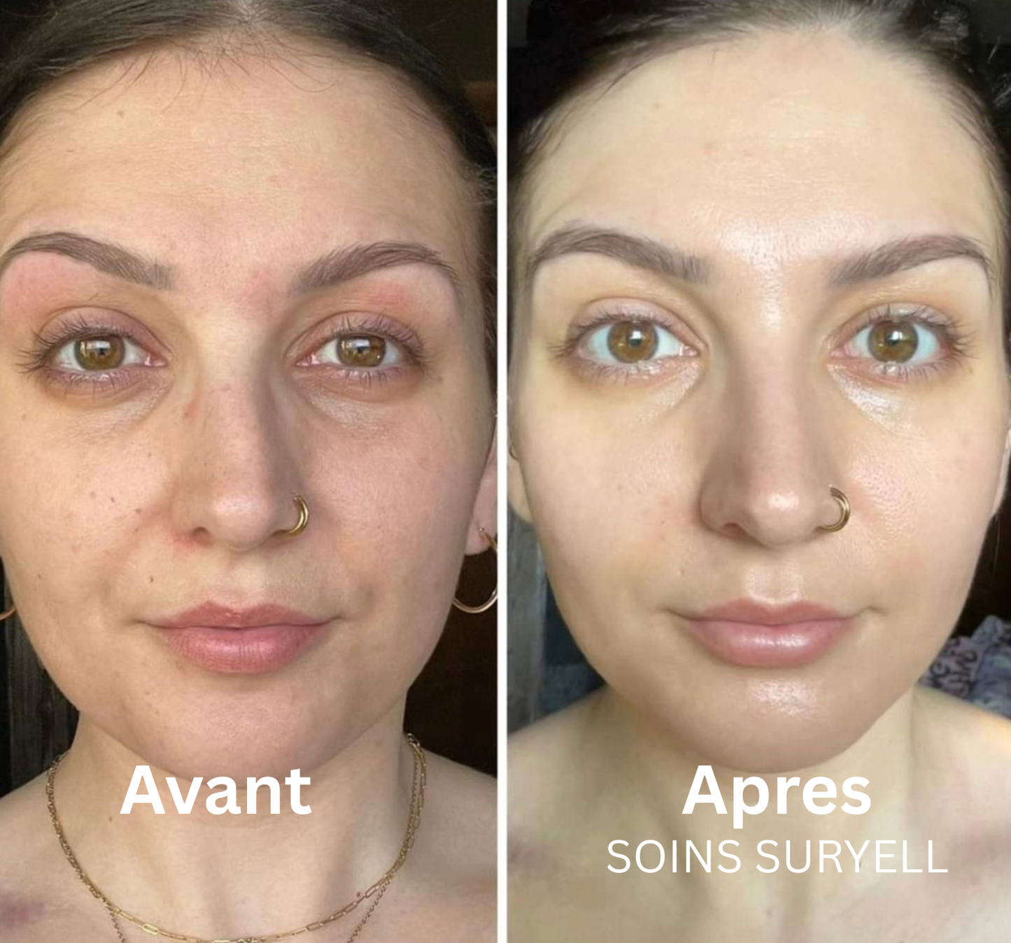 Soins Retinal Anti-Cernes instantané