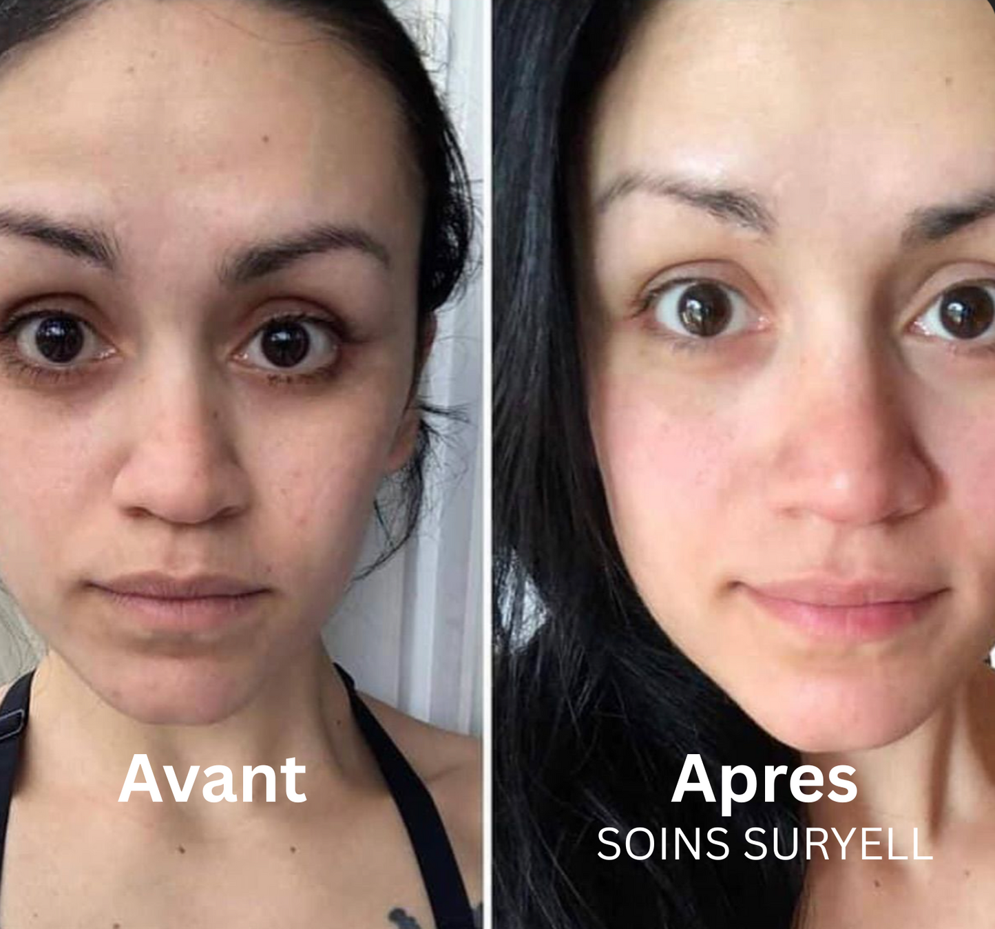 Soins Retinal Anti-Cernes instantané