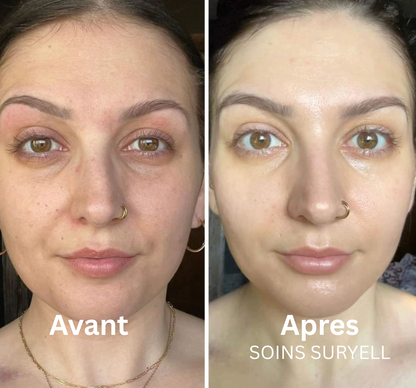 Soins Retinal Anti-Cernes instantané